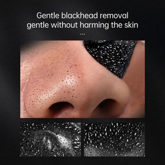 FreshPure | Blackhead Remover Peel-Off Maske für strahlende Haut