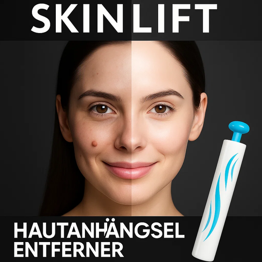 SkinLift | Schmerzfreies Hautpflege-Entfernungsset