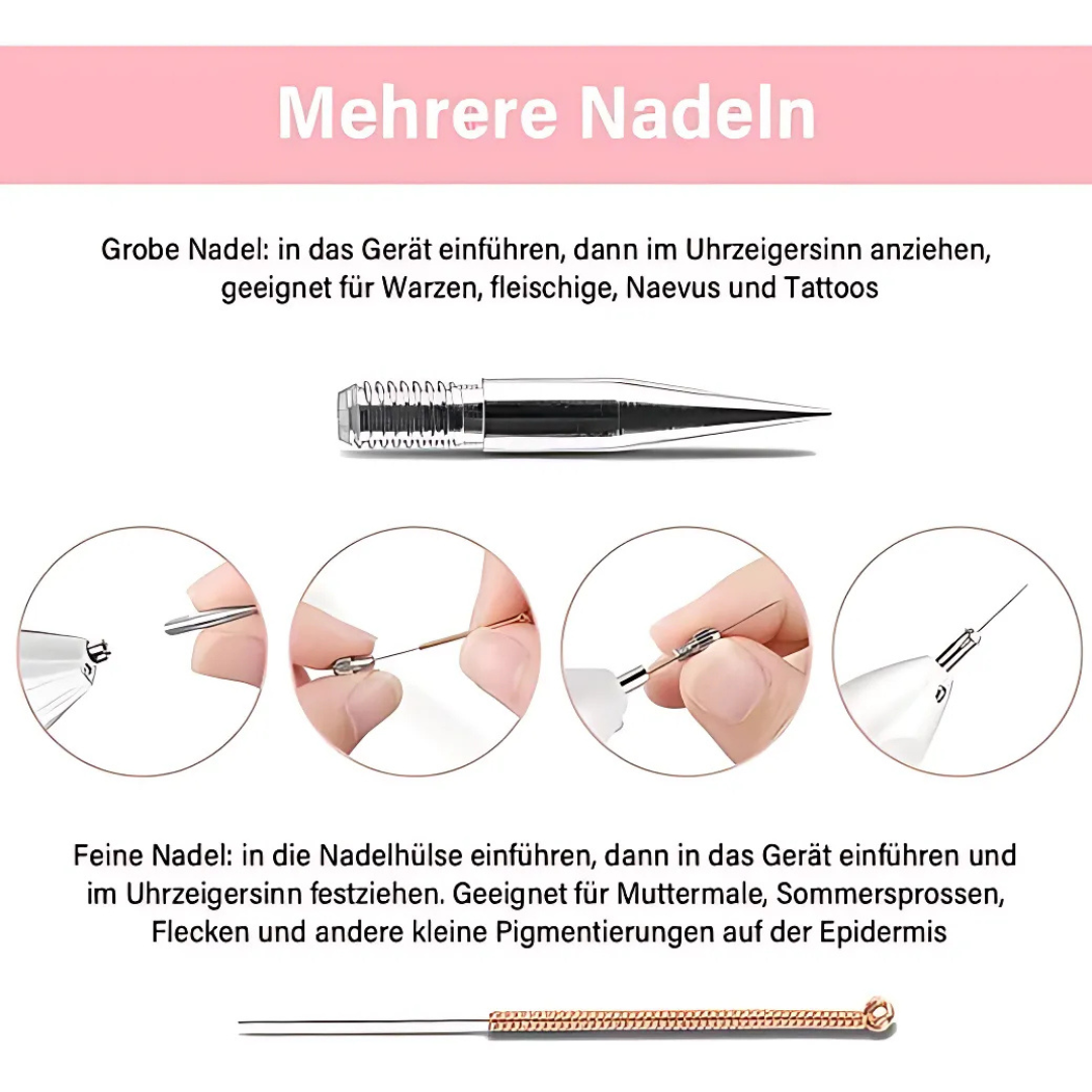 Skinea | Plasma-Stift zur sicheren Entfernung von Hautmakeln
