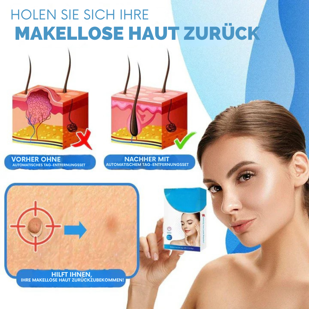 SkinLift | Schmerzfreies Hautpflege-Entfernungsset