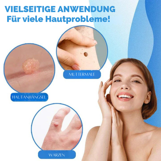 SkinLift | Schmerzfreies Hautpflege-Entfernungsset