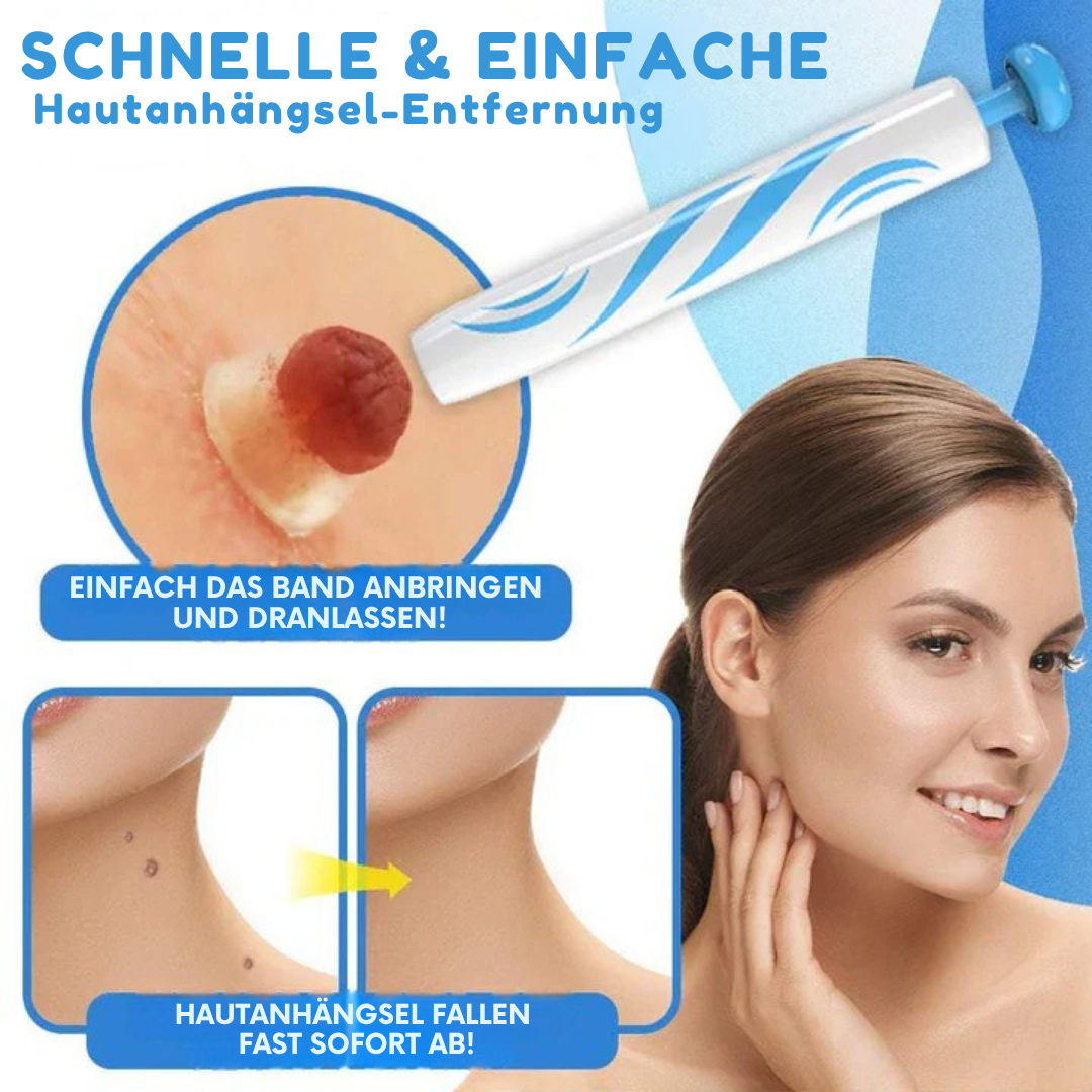 SkinLift | Schmerzfreies Hautpflege-Entfernungsset