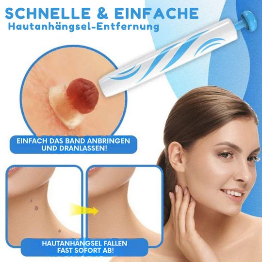 SkinLift | Schmerzfreies Hautpflege-Entfernungsset