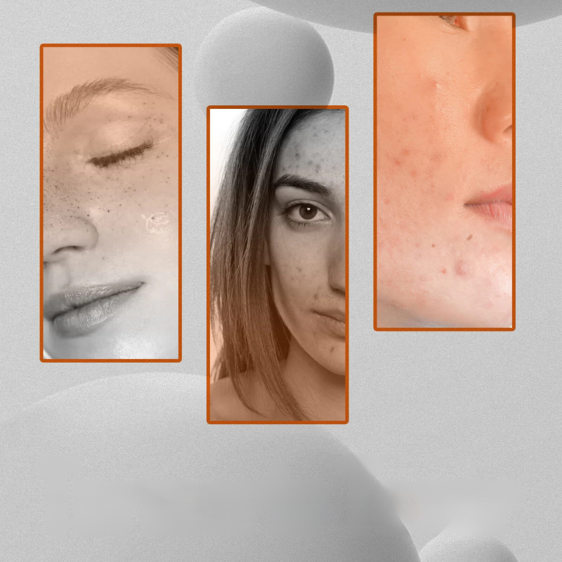 SpotGlow | Dunkle Flecken Korrektor & Aufhellende Gesichtspflege