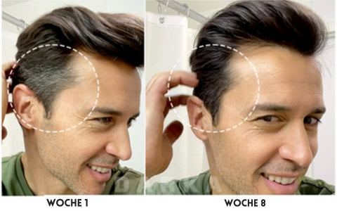 ColorRevive | Anti-Grau-Haarserum – Gibt grauen Haaren ihre natürliche Farbe zurück