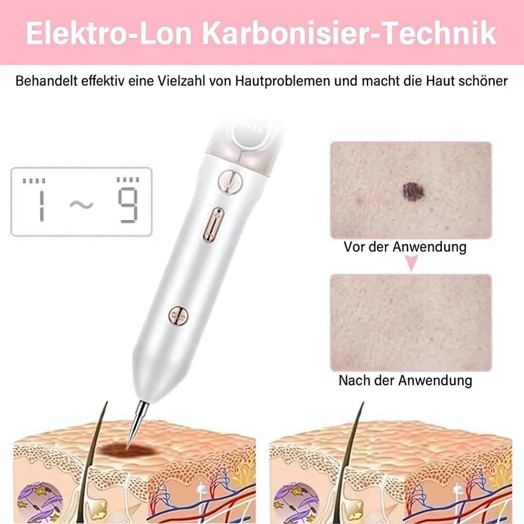Skinea | Plasma-Stift zur sicheren Entfernung von Hautmakeln