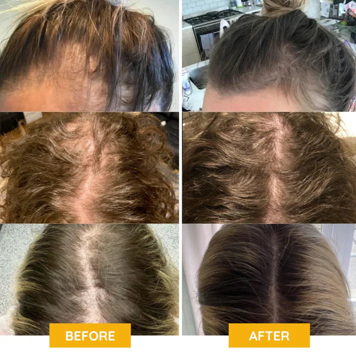 GrowThrive | Veganes Haarwuchsollexir
