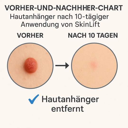 SkinLift | Schmerzfreies Hautpflege-Entfernungsset