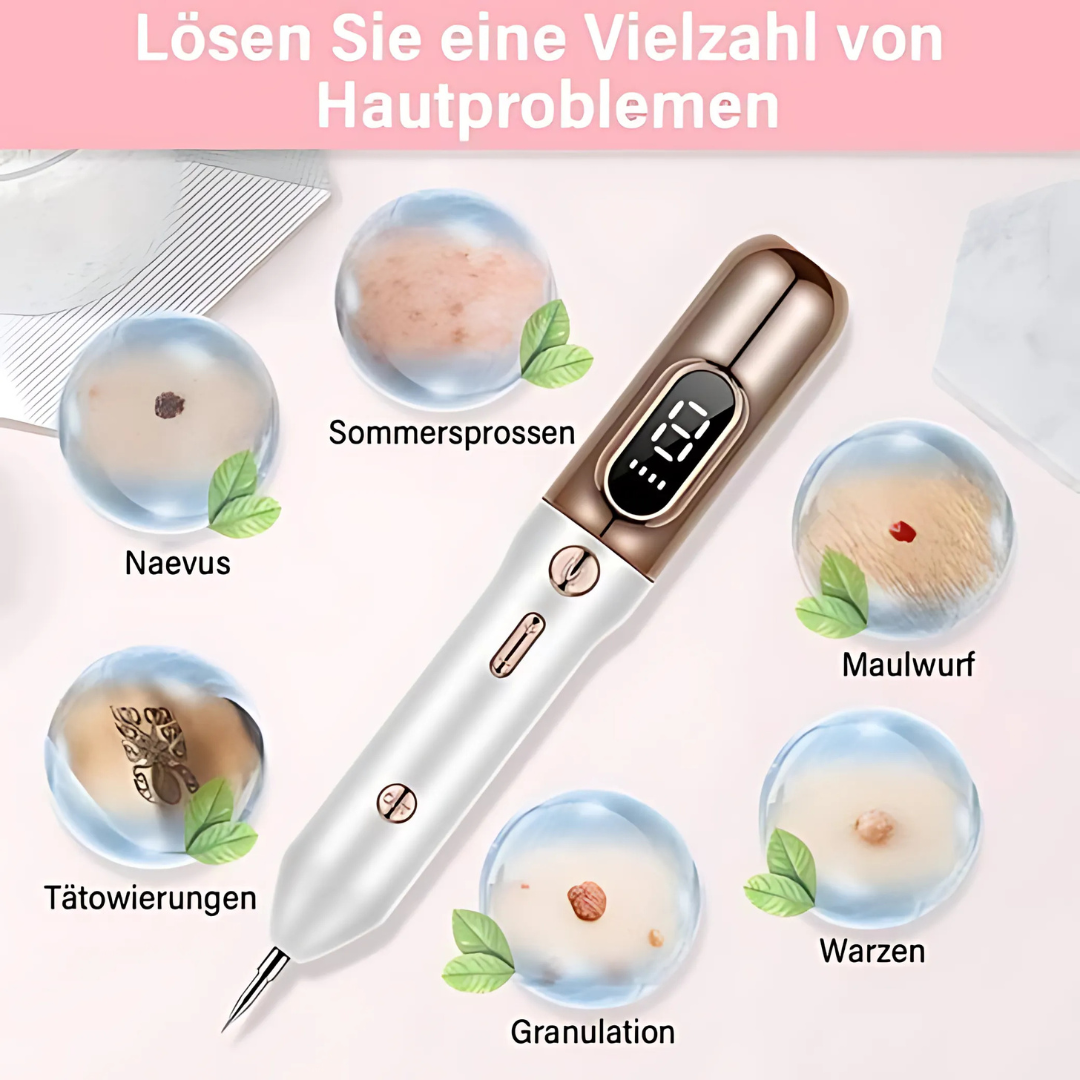 Skinea | Plasma-Stift zur sicheren Entfernung von Hautmakeln