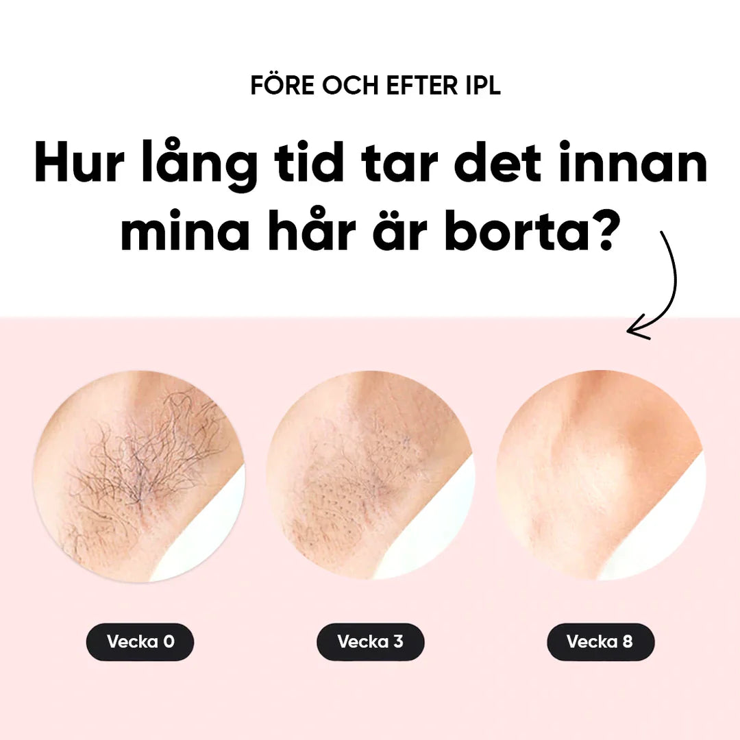LumeaTouch | IPL – Dauerhafte Haarentfernung