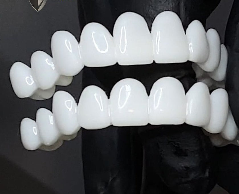 DentGlow | Verstellbare Zahnprothese – Natürlicher Look & Passform