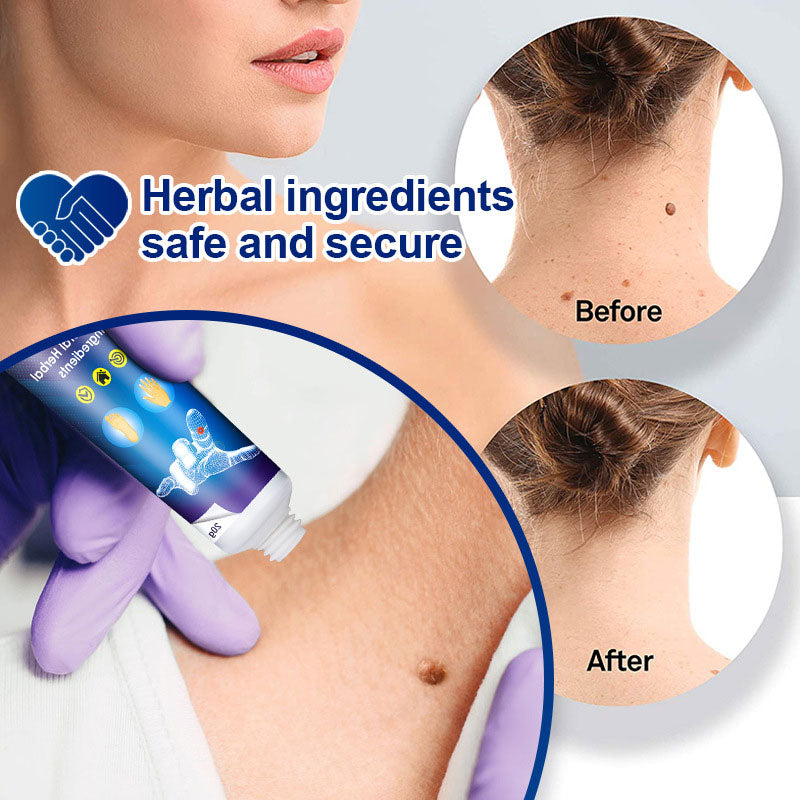 SkinEase | Hautpflege Creme – Feuchtigkeit & Sanfte Entfernung