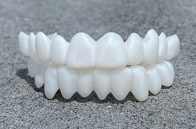 DentGlow | Verstellbare Zahnprothese – Natürlicher Look & Passform