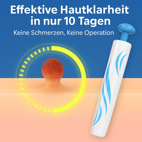 SkinLift | Schmerzfreies Hautpflege-Entfernungsset