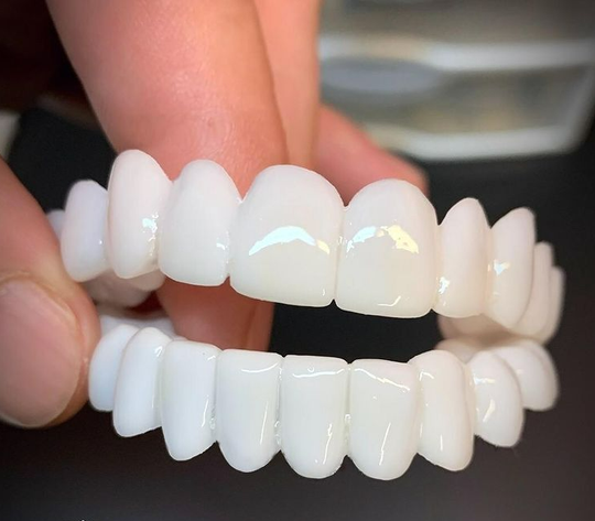 DentGlow | Verstellbare Zahnprothese – Natürlicher Look & Passform