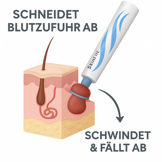 SkinLift | Schmerzfreies Hautpflege-Entfernungsset