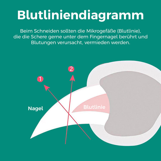 PawClip | Sicherer Nagelknipser mit Sensorschutz