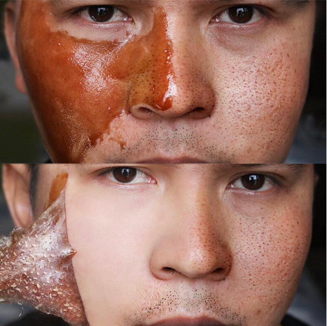 BrightPeel | Klärende Honigmaske gegen Hautunreinheiten