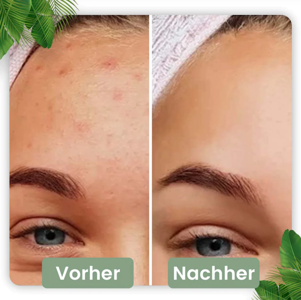 https://cdn.shopify.com/s/files/1/0178/2182/7136/products/GruenerTee-Extrakt-ReinigungsmaskeStick-Tiefenreinigung_Mitesserentfernen_PorenverkleinernundHautstraffen4.png?v=1681495516