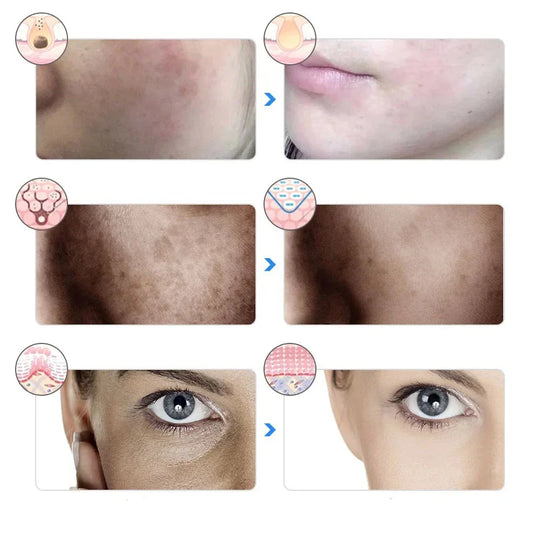 AgeGlow | 7-Farben LED-Therapie-Maske für Facelifting und Aufhellung