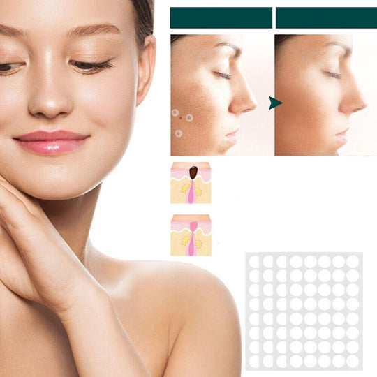 ClearDerm | Warzenentfernungsstreifen – Sicher & Bequem für Alle Hauttypen