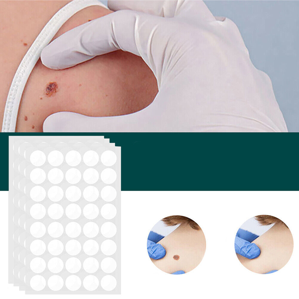 ClearDerm | Warzenentfernungsstreifen – Sicher & Bequem für Alle Hauttypen