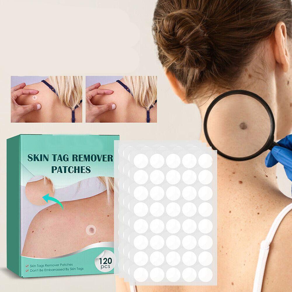 ClearDerm | Warzenentfernungsstreifen – Sicher & Bequem für Alle Hauttypen