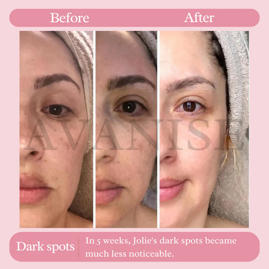 AvanyGlow | Sanfte Hautaufhellungspads Decorique.de