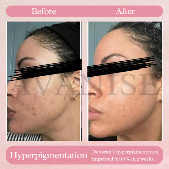 AvanyGlow | Sanfte Hautaufhellungspads Decorique.de