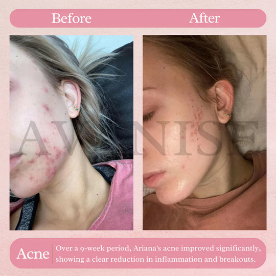 AvanyGlow | Sanfte Hautaufhellungspads Decorique.de