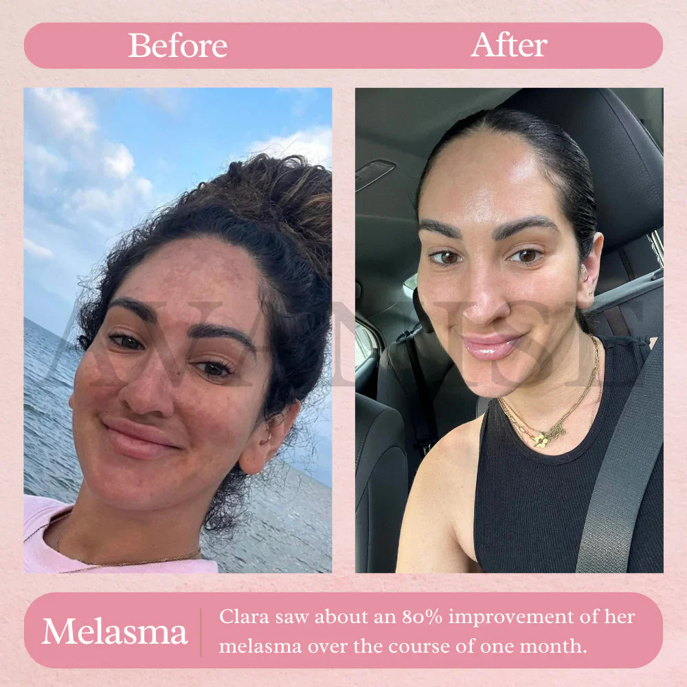 AvanyGlow | Sanfte Hautaufhellungspads Decorique.de