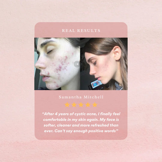 AvanyGlow | Sanfte Hautaufhellungspads Decorique.de