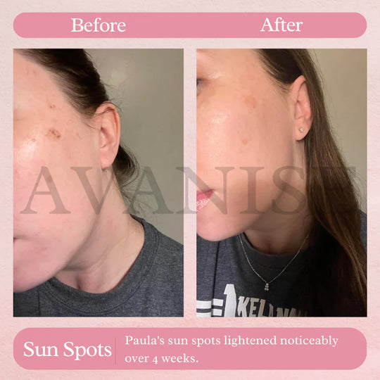 AvanyGlow | Sanfte Hautaufhellungspads Decorique.de