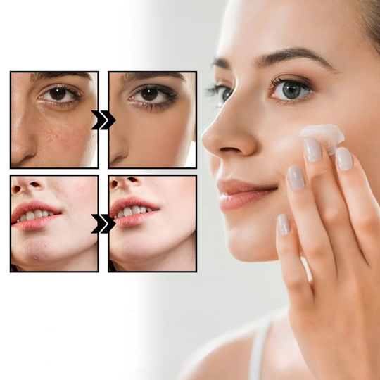 CalmAura | Reparationscreme für Rosazea & Rötungslinderung Decorique.de