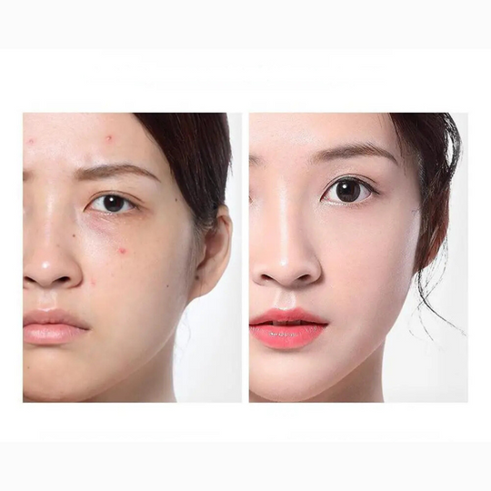 ClearSkin | Ampullen Toner Aknepflege & Feuchtigkeitsserum Decorique.de