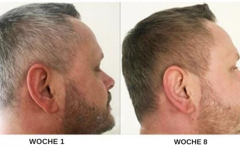 ColorRevive | Anti-Grau-Haarserum – Gibt grauen Haaren ihre natürliche Farbe zurück Decorique.de