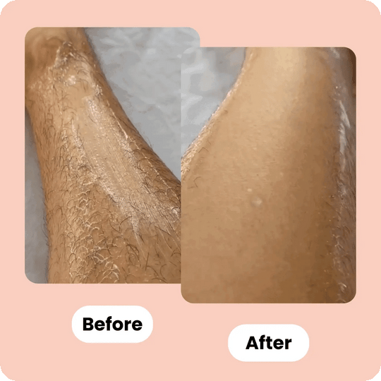 SilkLady | Premium Rasiermesser mit Basis