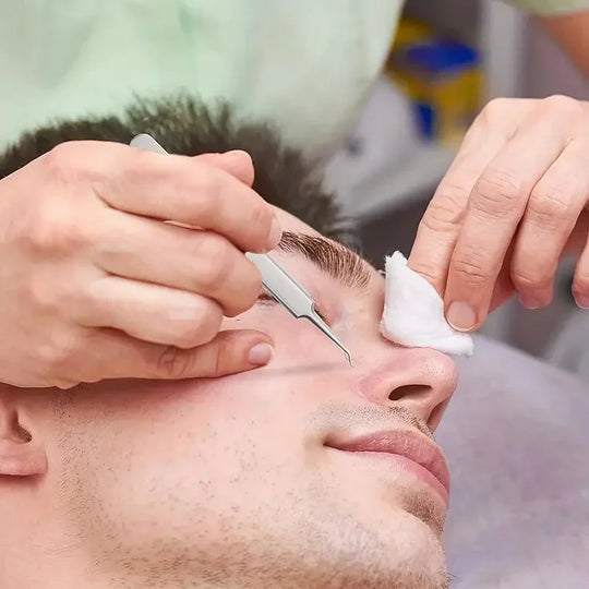 PoreSharp | Präzise Pinzetten für Mitesser & Whiteheads