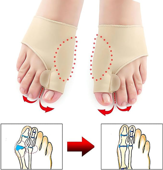 FlexiToe | Orthopädischer Zehenspreizer mit Massageball Decorique.de