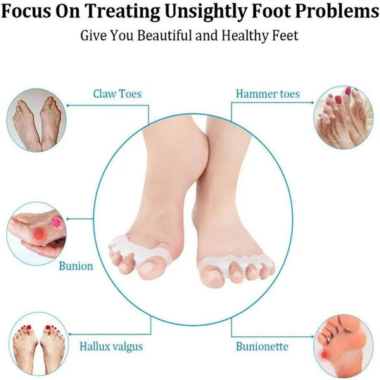 FootEase | Orthopädischer Hammerzeh-Spange Zubehör (Paar) Decorique.de