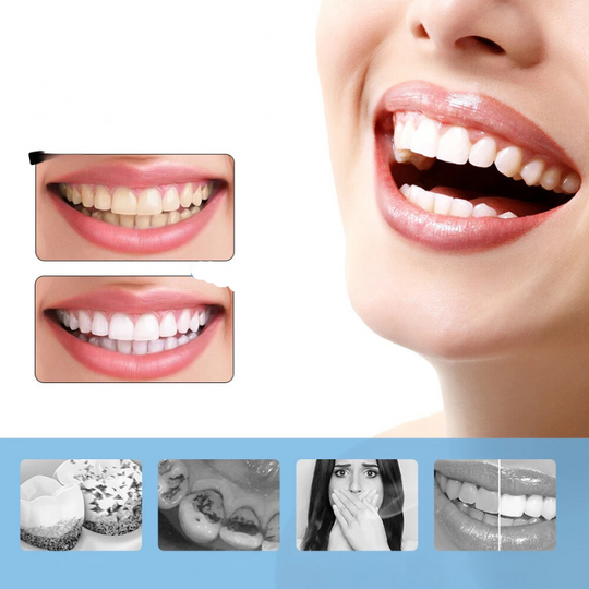 FreshWhite | 6-Gang Elektrischer Zahnaufheller & Skaler Decorique.de