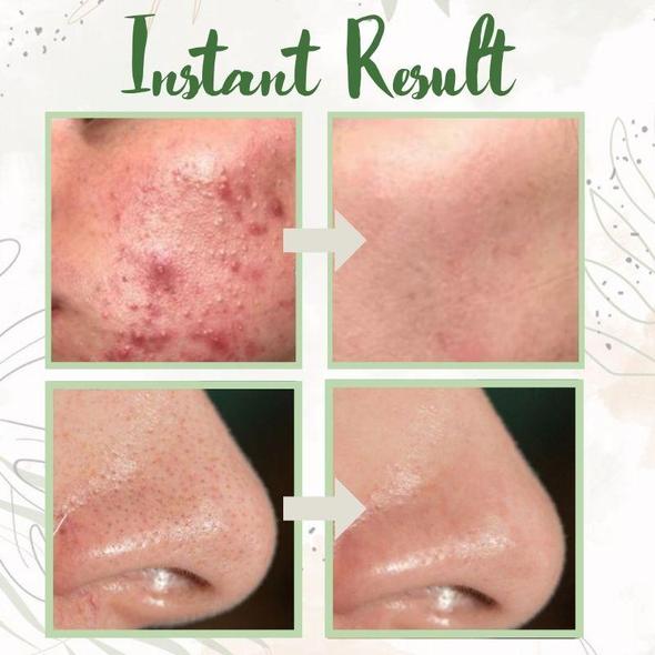 GlowPur | Deep-Cleansing Green Tea Face Mask Decorique.de