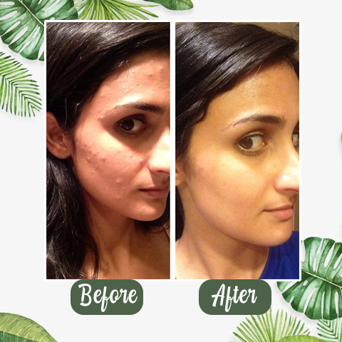 GlowPur | Deep-Cleansing Green Tea Face Mask Decorique.de