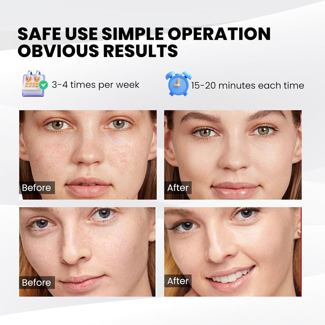 GlowTherapy | Hautverjüngende Lichttherapie-Maske Decorique.de