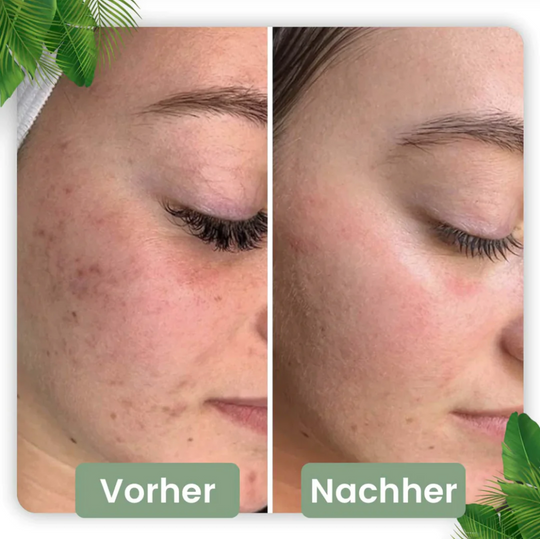 GreenCare | Tiefenreinigung mit grünem Tee Decorique.de