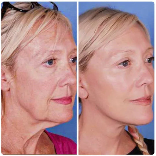 LiftSculpt | EMS-Mikrostrom-Massagegerät Decorique.de