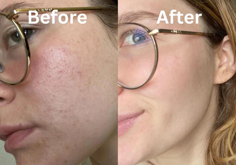 LiftSculpt | EMS-Mikrostrom-Massagegerät Decorique.de