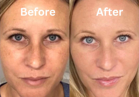 LiftSculpt | EMS-Mikrostrom-Massagegerät Decorique.de