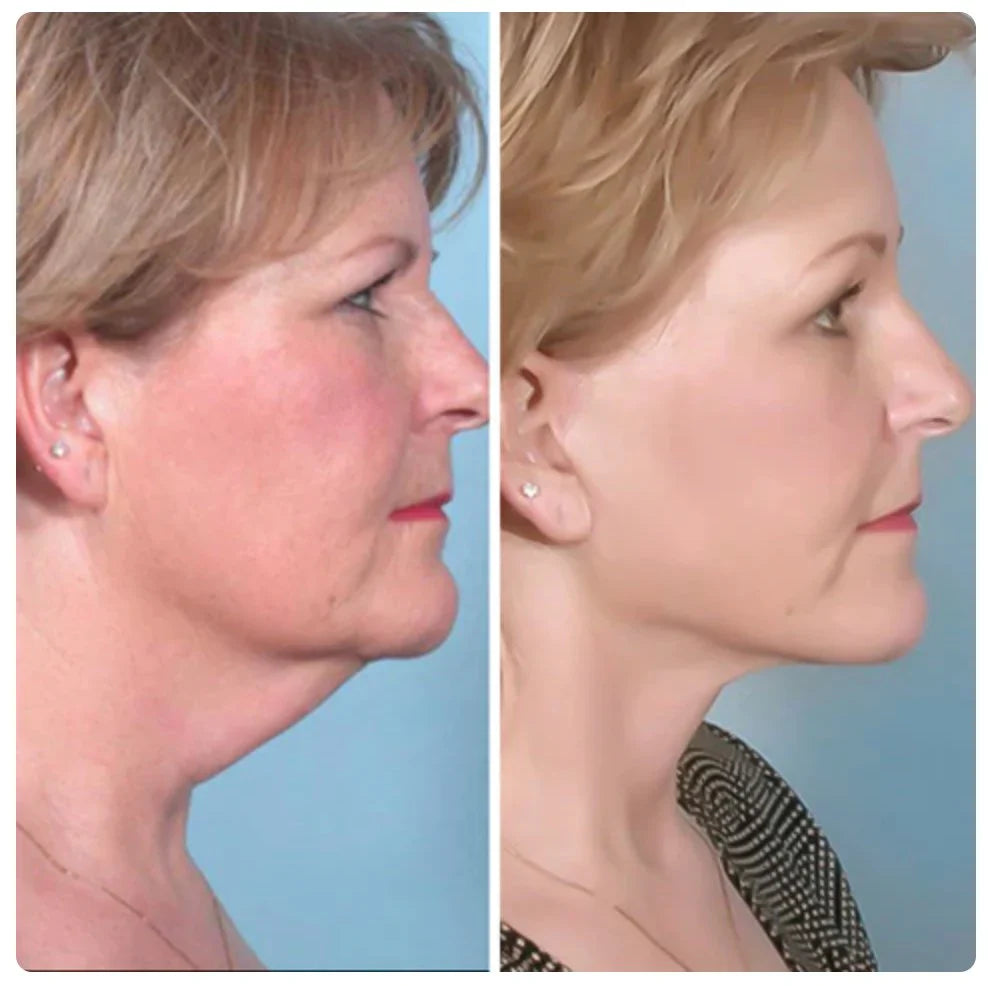 LiftSculpt | EMS-Mikrostrom-Massagegerät Decorique.de