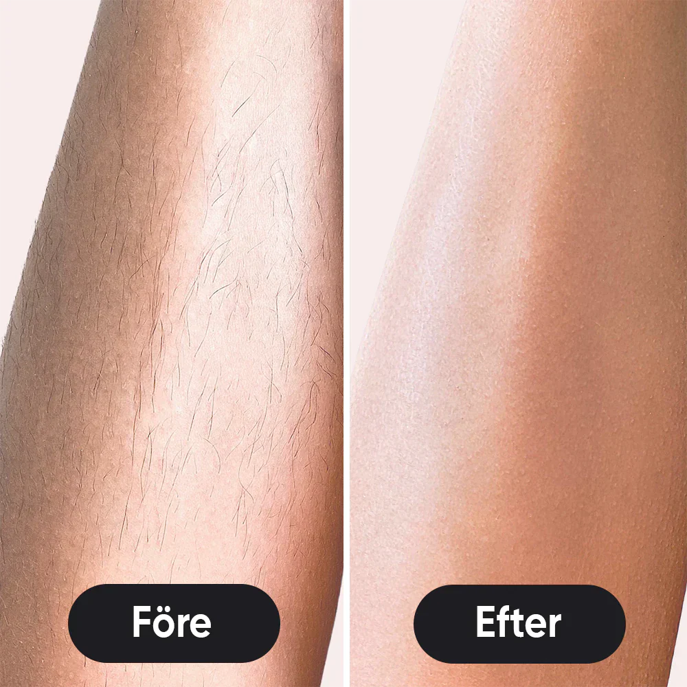 LumeaTouch | IPL – Dauerhafte Haarentfernung Decorique.de